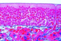 Mikropräparat - Riechepithel (Regio olfactoria) der Nasenschleimhaut, quer