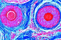 Mikropräparat - Kopfhaut mit Haaren, Haarwurzeln quer Mikropräparat - Kopfhaut mit Haaren, Haarwurzeln quer