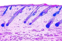 Mikropräparat - Kopfhaut vom Foetus, Haarwurzeln längs