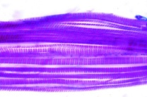 Mikropräparat - Quergestreifte Muskeln im Schnitt durch Insektenthorax