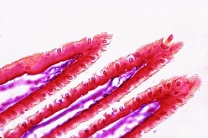 Mikropräparat - Sensillen im Fühler eines Insekts, quer Mikropräparat - Sensillen im Fühler eines Insekts, quer