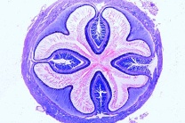 Mikropräparat - Carabus, Laufkäfer, Kaumagen quer