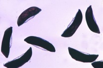 Mikropräparat - Anopheles, Eier total Mikropräparat - Anopheles, Eier total