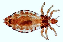 Mikropräparat - Pediculus humanus corporis, Kleiderlaus, total