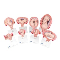 Schwangerschafts - Serie, 8 Modelle