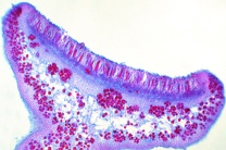 Mikropräparat - Physcia, Apothezium mit Asci und Sporen, quer