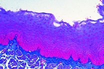 Mikropräparat - Mehrschichtiges, nicht verhorntes Plattenepithel im Schnitt durch den Ösophagus vom Kaninchen Mikropräparat - Mehrschichtiges, nicht verhorntes Plattenepithel im Schnitt durch den Ösophagus vom Kaninchen