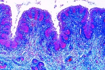 Mikropräparat - Mehrschichtiges, nicht verhorntes Plattenepithel im Schnitt durch die Vagina vom Schwein Mikropräparat - Mehrschichtiges, nicht verhorntes Plattenepithel im Schnitt durch die Vagina vom Schwein