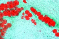 Mikropräparat - Fettgewebe vom Schwein, Fett in situ. Fettfärbung mit Sudan III
