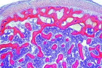 Mikropräparat - Knochen vom Rind, spongiöse Substanz, quer Mikropräparat - Knochen vom Rind, spongiöse Substanz, quer