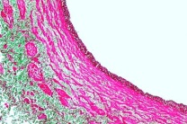 Mikropräparat - Vene der Katze, quer Mikropräparat - Vene der Katze, quer