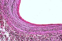 Mikropräparat - Vene der Katze, quer. Färbung der elastischen Fasern