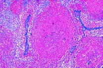 Mikropräparat - Lymphknoten vom Schwein, quer.