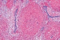 Mikropräparat - Lymphknoten der Katze, quer Mikropräparat - Lymphknoten der Katze, quer