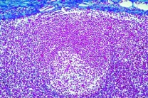 Mikropräparat - Milz, Meerschwein, quer Mikropräparat - Milz, Meerschwein, quer