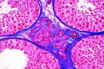 Mikropräparat - Leydigsche Zwischenzellen im Hodengewebe der Maus, quer