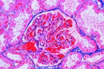 Mikropräparat - Niere des Hundes, quer