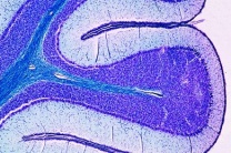 Mikropräparat - Kleinhirn, quer, Markscheidenfärbung * Mikropräparat - Kleinhirn, quer, Markscheidenfärbung *