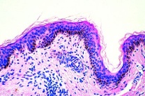Mikropräparat - Körperhaut vom Menschen (Neger), quer (vertikal)
