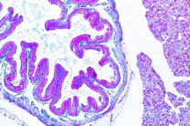 Mikropräparat - Helix pomatia, Magen mit Drüsen, quer
