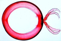 Mikropräparat - Julus, Diplosegment mit zwei Beinpaaren, total