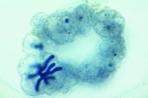 Mikropräparat - Ascaris megalocephala Embryologie. Uterus quer: Ältere...