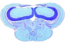 Mikropräparat - Cyprinus, Gehirn quer