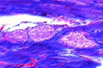 Mikropräparat - Trypanosoma cruzi, Leishmania-Formen, Herzmuskel Maus quer Mikropräparat - Trypanosoma cruzi, Leishmania-Formen, Herzmuskel Maus quer