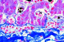 Mikropräparat - Plasmodium spec., exoerythrocytäre Formen in der Leber, Schnitt