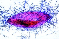 Mikropräparat - Paramaecium, Trichocysten (Karbolfuchsin)