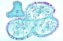 Mikropräparat - Psilotum, dreifächeriges Sporangium mit Isosporen, quer * Mikropräparat - Psilotum, dreifächeriges Sporangium mit Isosporen, quer *