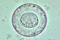 Mikropräparat - Hymenolepis diminuta, Eier, total Mikropräparat - Hymenolepis diminuta, Eier, total