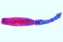 Mikropräparat - Echinococcus granulosus, Blasenwurm