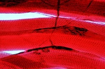 Mikropräparat - Tropidonotus, Ringelnatter, Quergestreifte Muskulatur, längs