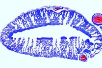 Mikropräparat - Lacerta, Lunge quer. Stärkere Faltung der Innenwand Mikropräparat - Lacerta, Lunge quer. Stärkere Faltung der Innenwand