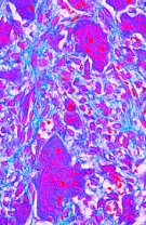 Krankheiten des Menschen (Pathologie), Ergänzungssatz von 12 Ein Krankheiten des Menschen (Pathologie), Ergänzungssatz von 12 Ein