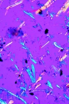 Luftverschmutzung und Allergene, Basissatz von 6 Einheiten, Schü