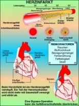 Transparentsatz Herzinfarkt