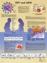 Anatomische Lehrtafel, HIV und Aids