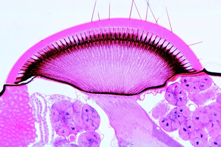 Mikropräparate - Wirbellose Tiere (Invertebrata), Ergänzungsserie