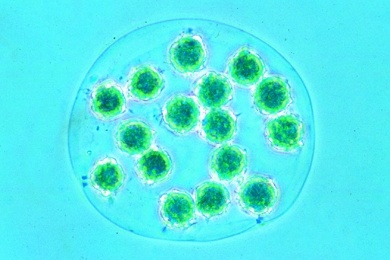 Mikropräparat -Eudorina, koloniebildende Geißelalge mit Gallerthülle