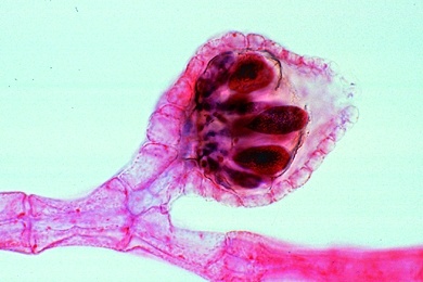 Mikropräparat - Polysiphonia, marine Rotalge, Zystokarp