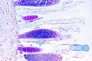 Mikropräparat - Mnium, Laubmoos, Antheridienstand, längs, Antheridien
