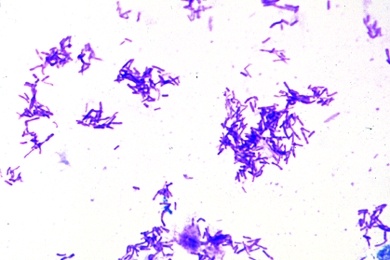 Mikropräparat - Proteus vulgaris, Entzündungen der Harnwege, Ausstrich