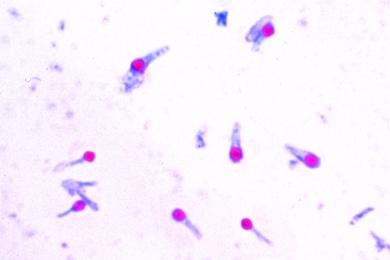 Mikropräparat Wundstarrkrampf, Ausstrich (Clostridium tetani)