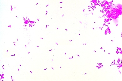 Mikropräparat - Vibrio comma, Erreger der asiatischen Cholera, Ausstrich