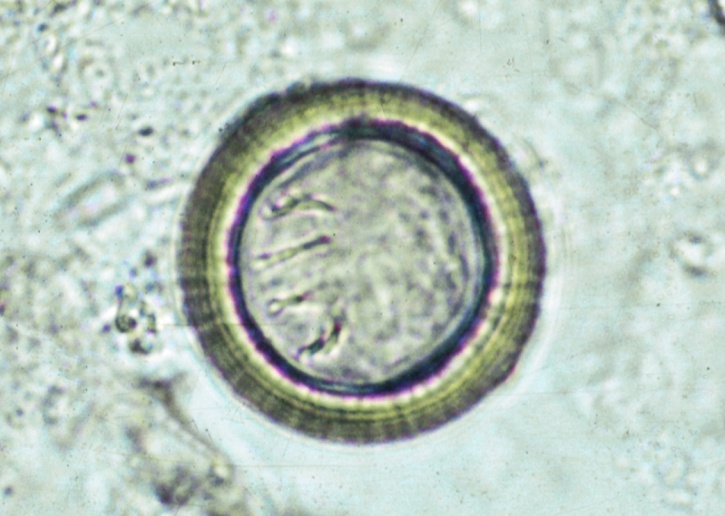 Mikropräparat - Taenia saginata, Rinderbandwurm, Eier im Stuhl