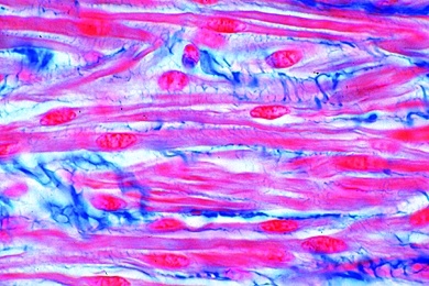 Mikropräparat - Glatte Muskeln vom Säugetier, quer und längs