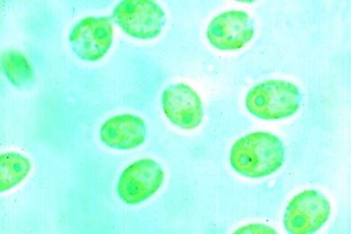 Mikropräparat - Geißelalge (Chlamydomonas), einzellige Grünalge in Massenvorkommen