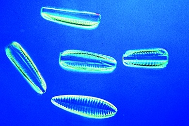 Mikropräparat - Kieselalgen (Diatomeen), Leitorganismen für mäßig bis kaum verunreinigte, sauerstoffreiche Gewässer